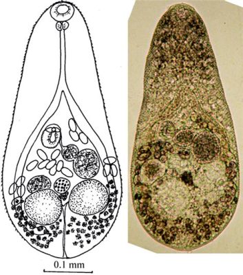  Metagonimus yokogawai: A Tiny Trematode With an Appetite for Snail Slime and Fish Guts!